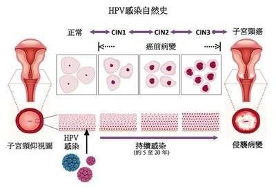 打了HPV疫苗为什么还会得宫颈癌？  第1张