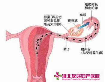 输卵管不通症状有哪些？常见症状及识别方法详解